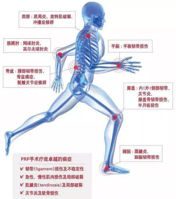 11月22日（北京）PRP技术骨病疼痛临床应用讲习班